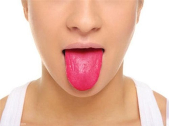 Các dấu hiệu ở lưỡi cảnh báo bệnh nghiêm trọng